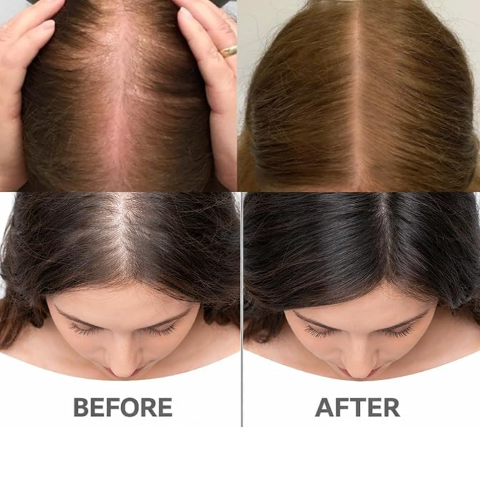 Plant-Based PDRN Scalp Hair Regrowth Gel